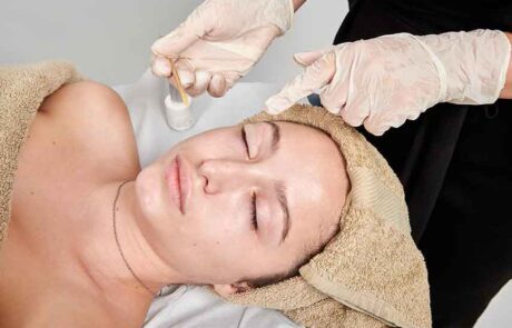 Aesthetics woman getting chemical peel