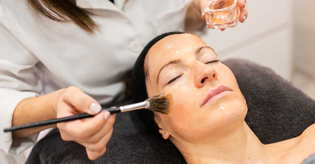 How Chemical Peels Support Your Skin