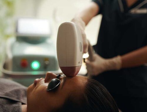 How IPL Treatments Can Revitalize Your Skin