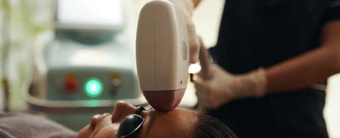 How IPL Treatments Can Revitalize Your Skin