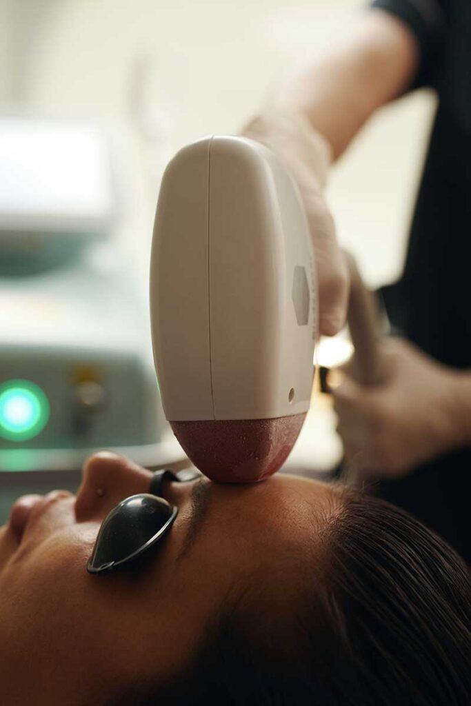 How IPL Treatments Can Revitalize Your Skin