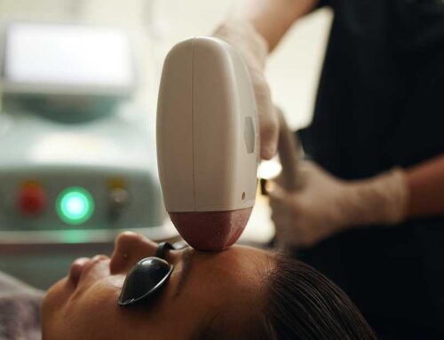 How IPL Treatments Can Revitalize Your Skin