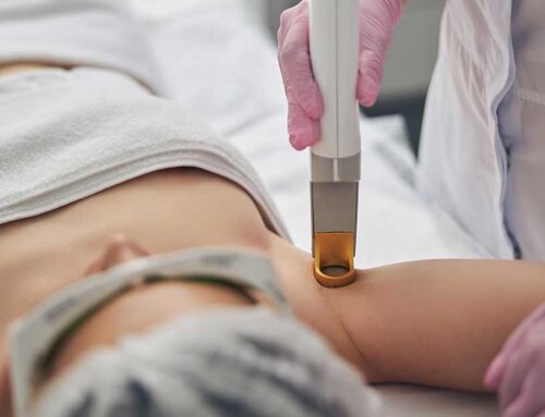 Laser Skin Treatments vs Traditional Methods