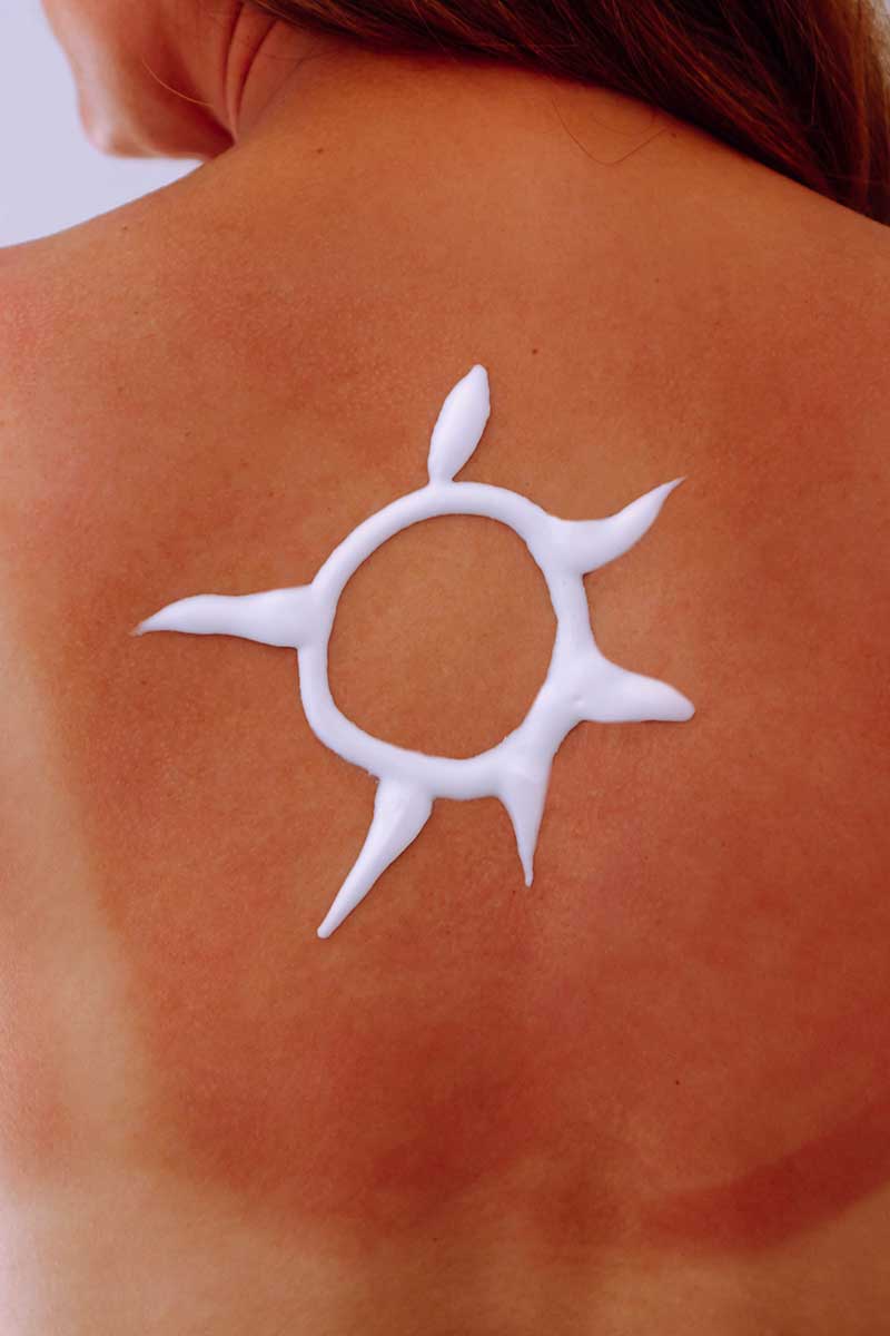 Sun-kissed or sun stressed? Sun-kissed or sun stressed?