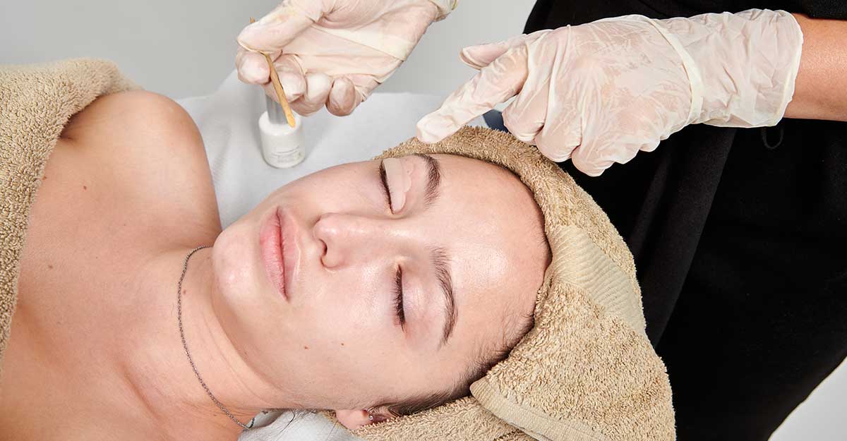 Best Time for a Chemical Peel