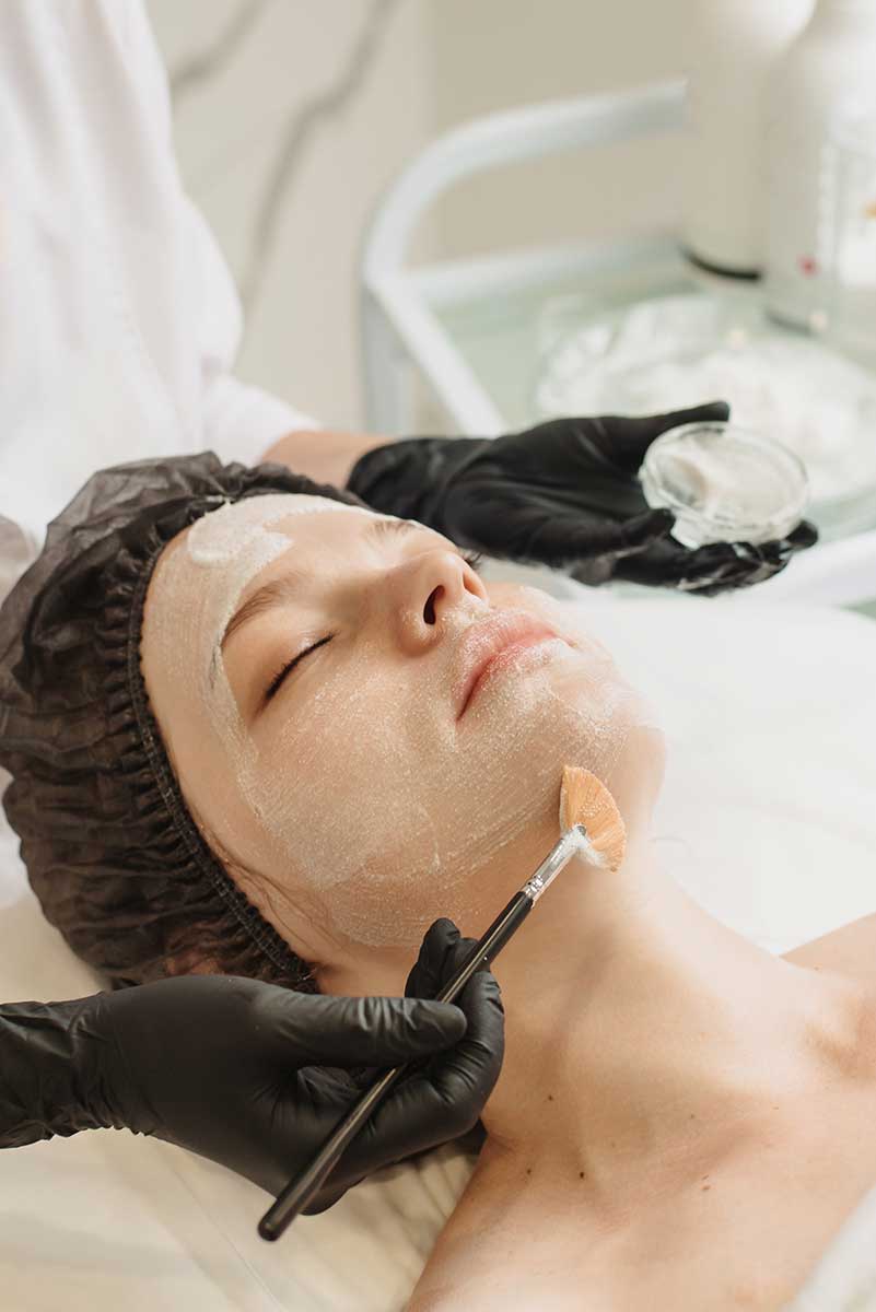 chemical peels and facials in carmel, indiana