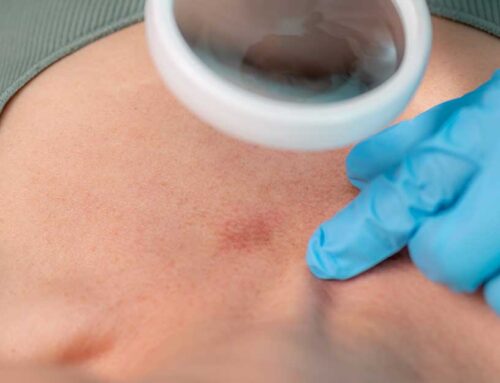 Year-Round Strategies for Skin Cancer Prevention