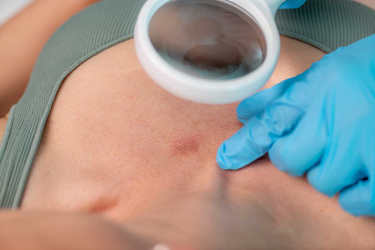 dermatologist checking on patient’s skin