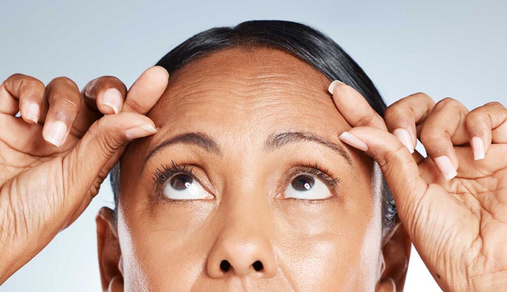 woman squeezing wrinkles on her forehead