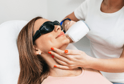 laser hair removal